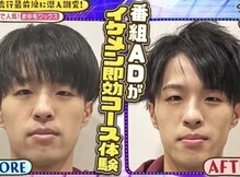 アカヌケ(AKANUKE)