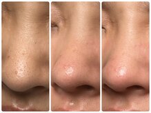 サイセイ(SAISEI)/メンズの毛穴洗浄もお任せ☆