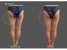 クレビア 麻布十番(CREBIA)/ラフォス1回【痩身/代謝促進】