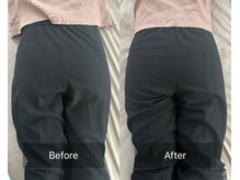 フェムーン(FEMOON)/フェムケア矯正（R)