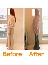 整体院ひなた 宮崎院/猫背反り腰改善で肩こり腰痛改善