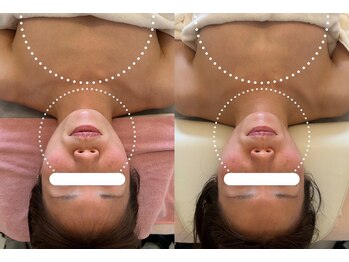 ナンバーナイン(No.9)/酵素UP美肌バザルトフェイシャル