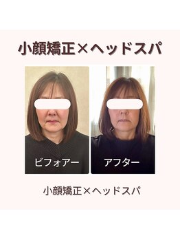 プレシャス(PRECIOUS)/小顔矯正×ヘッドスパ