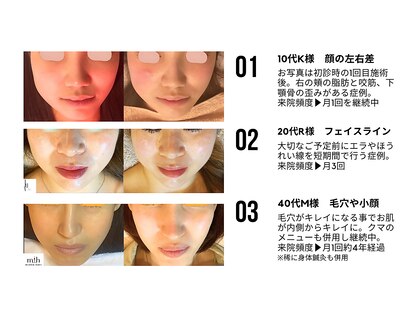 ミエリア美容鍼灸院(mielia美容鍼灸院)の写真