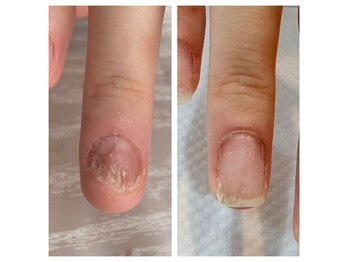 自爪育成ケア専門店 ネイルサロンLeaf