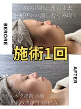 アネラ(ANELA)/即効果実感　1