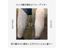 エアリアル 博多店の雰囲気（デリケートゾーン脱毛ならエアリアルへおまかせを！毛穴管理/）