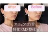 美容整体【むくみ・エラ張り】首リンパ+EMS小顔☆表情筋トレ→50分7200円