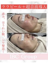 IBC 上大岡店/ツヤ肌に！ララピール