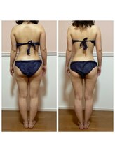 トータル フィルシャイン(Total Fillshine)/ダイエットモニター様