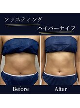 ハリルル 併設 GLケンタ鍼灸整骨院(HARILULU)/腸活との組み合わせで！