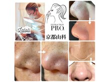 ラロリ(Laloli)