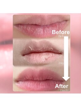 フィル 名駅店(fil)/ローマピンク【唇】