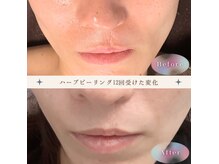 縫い跡のケアでお困りの方へ