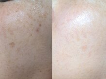 ルリノエプラスウイ(RURINOE+ui)の雰囲気（しっかりお肌の状態を見て、カウンセリングさせていただきます＊）