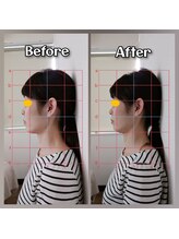 ぷめはな整体/before/After