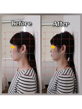 ぷめはな整体/before/After