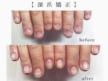 ヌチ ネイル(nuti nail)
