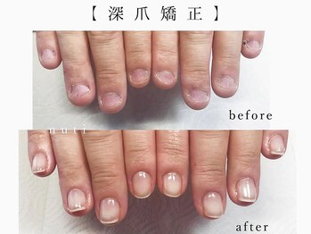 ヌチ ネイル(nuti nail)の写真/【深爪/卒業宣言】ブライダル爪育コース有☆