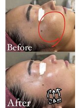 エクラ(ECLAT)/お顔のトーンアップ！！