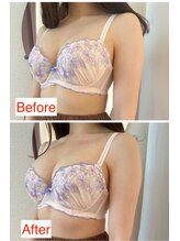 シエスタ(SIESTA)/Before→After バストはほぼ顔！