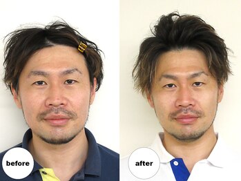 グランルーツ(GranRoots)/小顔矯正before/after