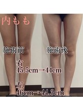 アモ(amo)/スッキリ美脚