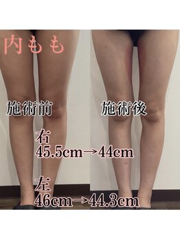 アモ(amo)/スッキリ美脚