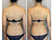 TMサロン 赤坂/ガチガチ肩をキリン首に★