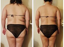 マナ(mana)/40代ダイエットコース1ヶ月経過