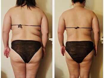 マナ(mana)/40代ダイエットコース1ヶ月経過