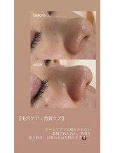 ファミーユ 太田(Fameu)/ハイドロスプラッシュ