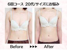 美人バスト リグラス(ReGrous)/バストアップbefore,after