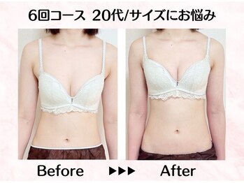 美人バスト リグラス(ReGrous)/バストアップbefore,after