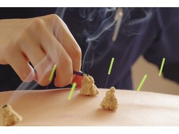 鍼灸マッサージ院 長津田駅前整骨院/鍼灸施術もお任せください