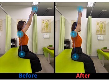 整骨院こころ 曙院/可動域の変化