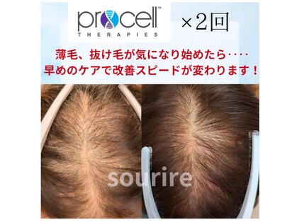 スリール(sourire)の写真