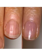 ロイヤル ビューティー サロン(Royal Beauty Saloon)/半年後は自慢の出来る爪に