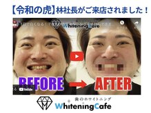 ホワイトニングカフェ 仙台店(WhiteningCafe)/☆ホワイトニングカフェ☆