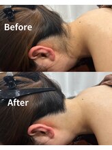 サロンリアンジュ ひたちなか店(Salon Liange)/◇うなじ脱毛◇