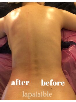 ラ ペジヴル(la Paisible)/筋膜リリースコー全身スリム