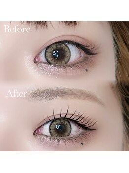 ハリス(HARIS)/脅威のビフォーアフター!