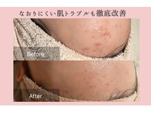 フォーウーマン(for woman)/ピーリング＋パック＋セルサー 