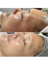 エステティックサロン S/ビフォーアフター