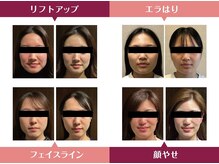 ラクアの雰囲気（効果重視のメニュー♪必ず実感していただけます♪）