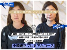 シンメトリー 札幌(SYMMETRY)の雰囲気（プロの施術であっと驚く変化！小顔矯正で新しい自分と出会える◎）
