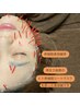 〈金森式〉幹細胞美容鍼　45分　¥18150→14850