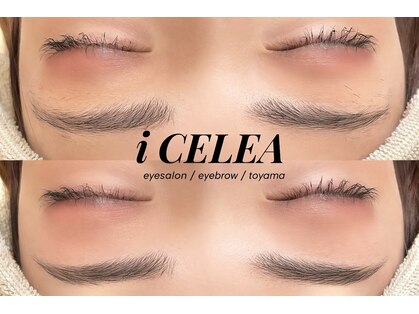 アイセレア(i CELEA)の写真