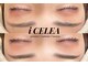 アイセレア(i CELEA)の写真