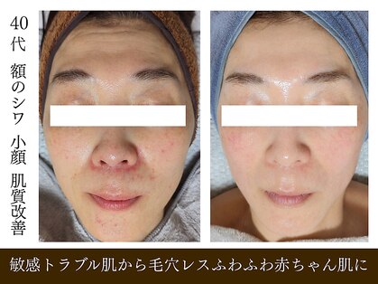 エボルブ 四条烏丸店(EVOLVE)の写真